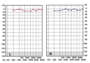 Average hearing chart